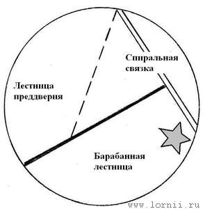 Рис. 2. Положение каудальной кохлеостомы по отношению к базилярной мембране и спиральной связке. Рис. 2. Положение каудальной кохлеостомы по отношению к базилярной мембране и спиральной связке.