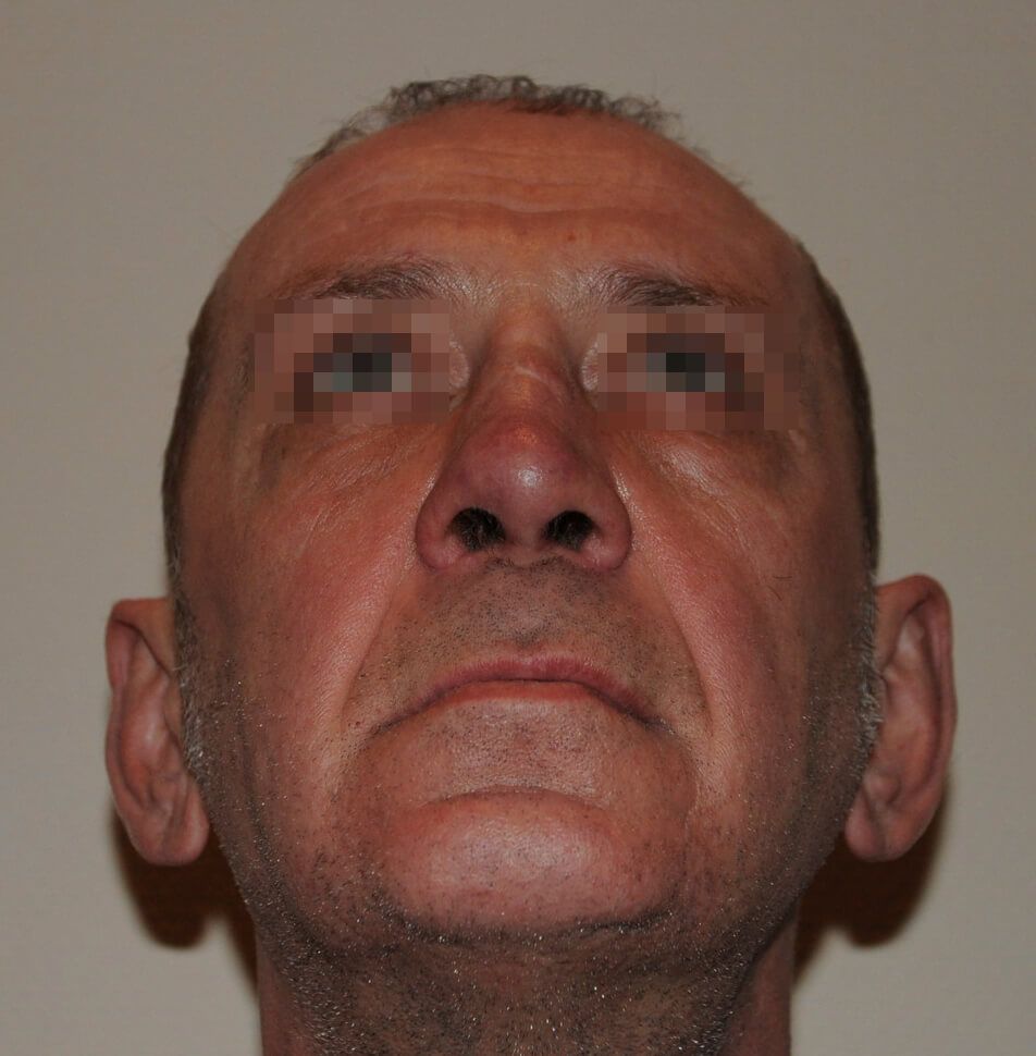 После операции После операции