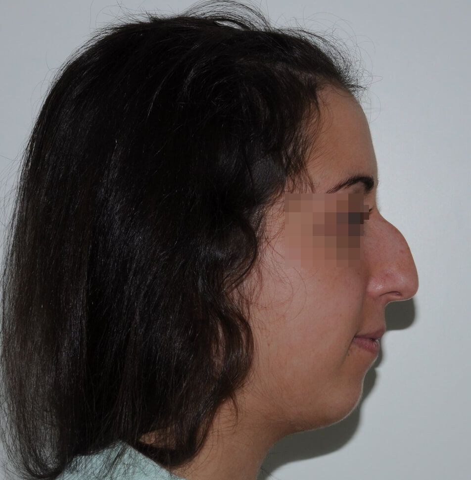 До операции До операции