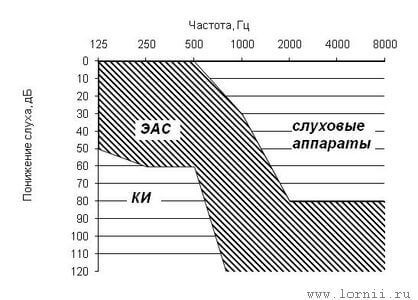 Диаграмма 1 - Критерии отбора пациентов для проведения КИ и ЭАС по данным тональной пороговой аудиометрии Диаграмма 1 - Критерии отбора пациентов для проведения КИ и ЭАС по данным тональной пороговой аудиометрии
