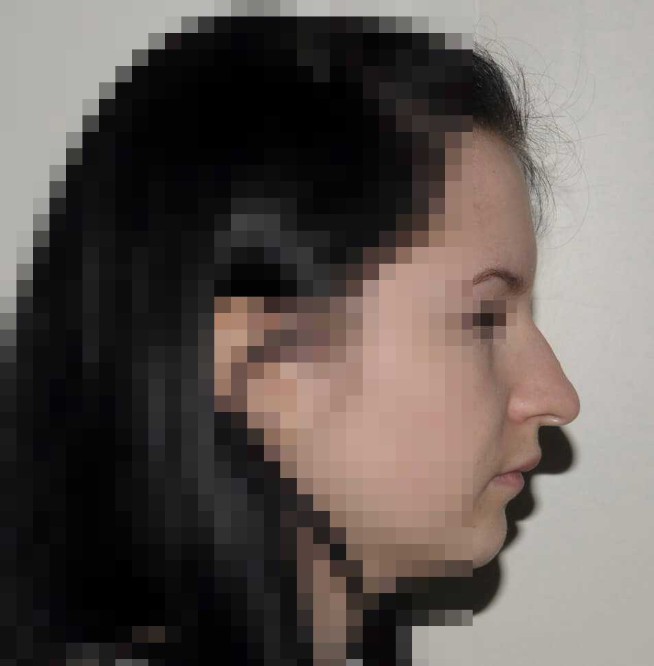 До операции До операции