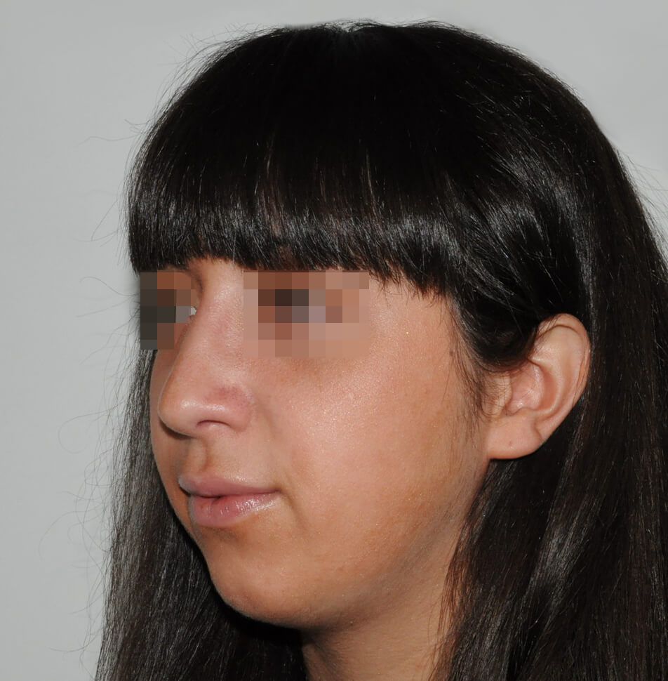 После операции После операции