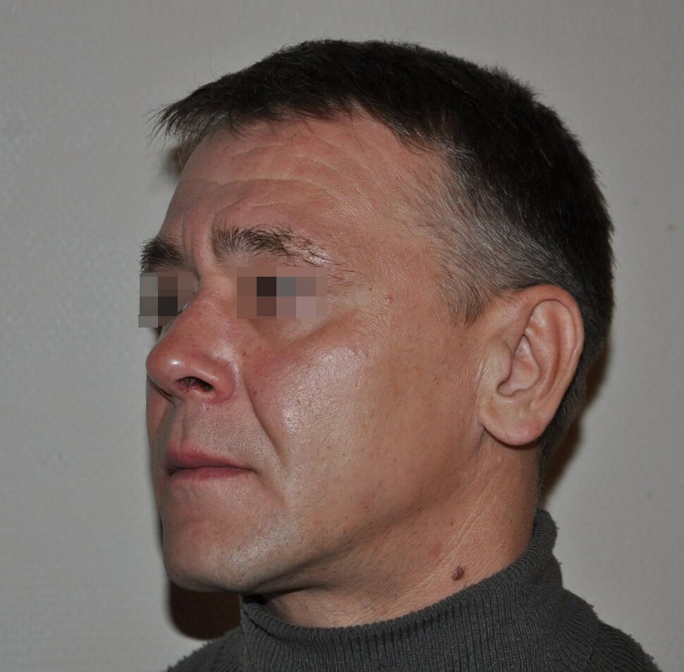 После операции После операции