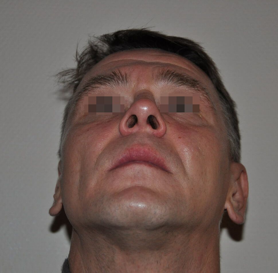 После операции После операции