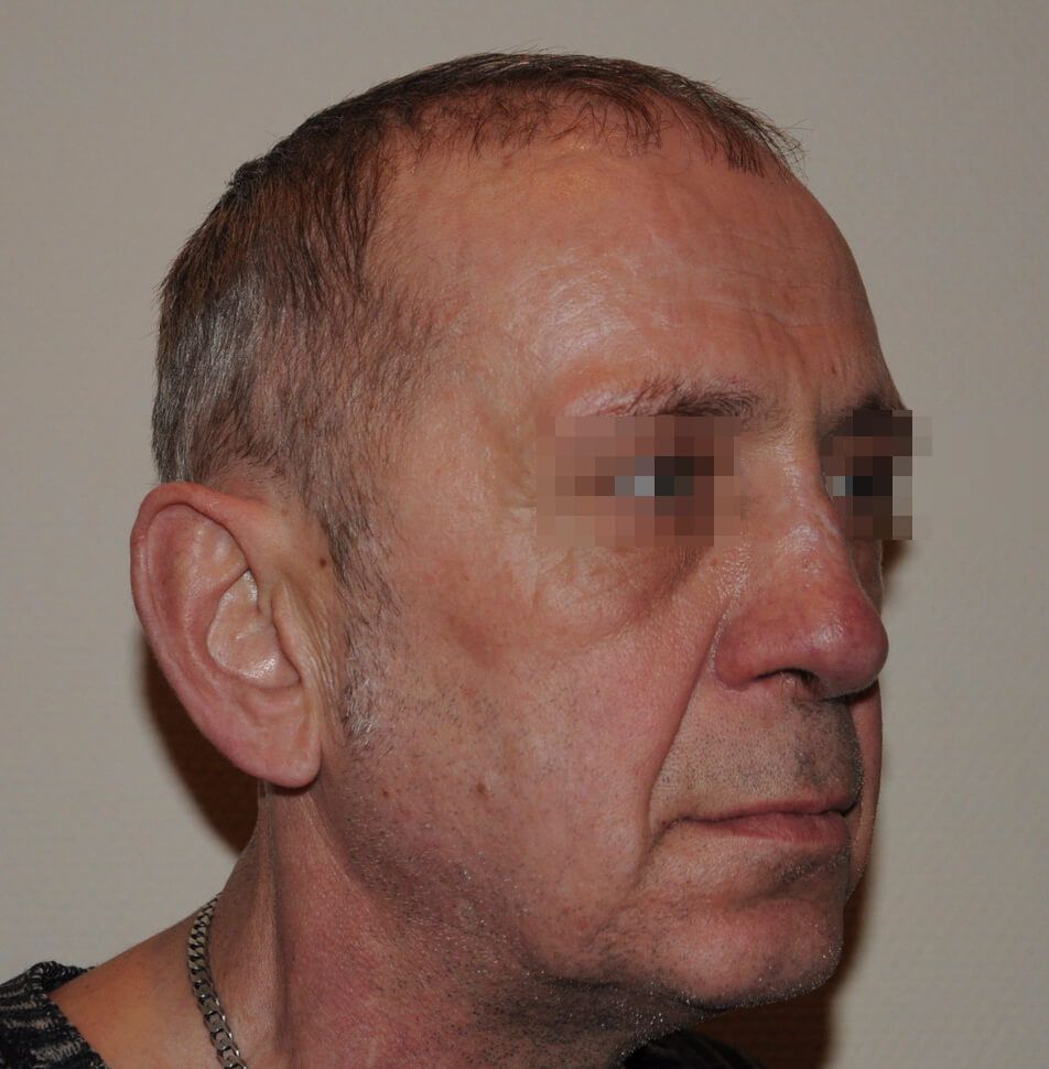 После операции После операции