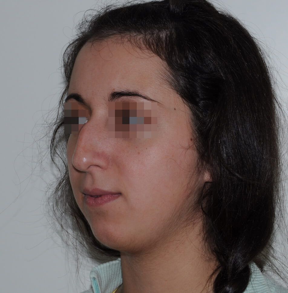 До операции До операции