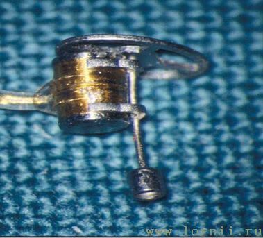 Рис.17. Фиксация катушки на полный протез Рис.17. Фиксация катушки на полный протез