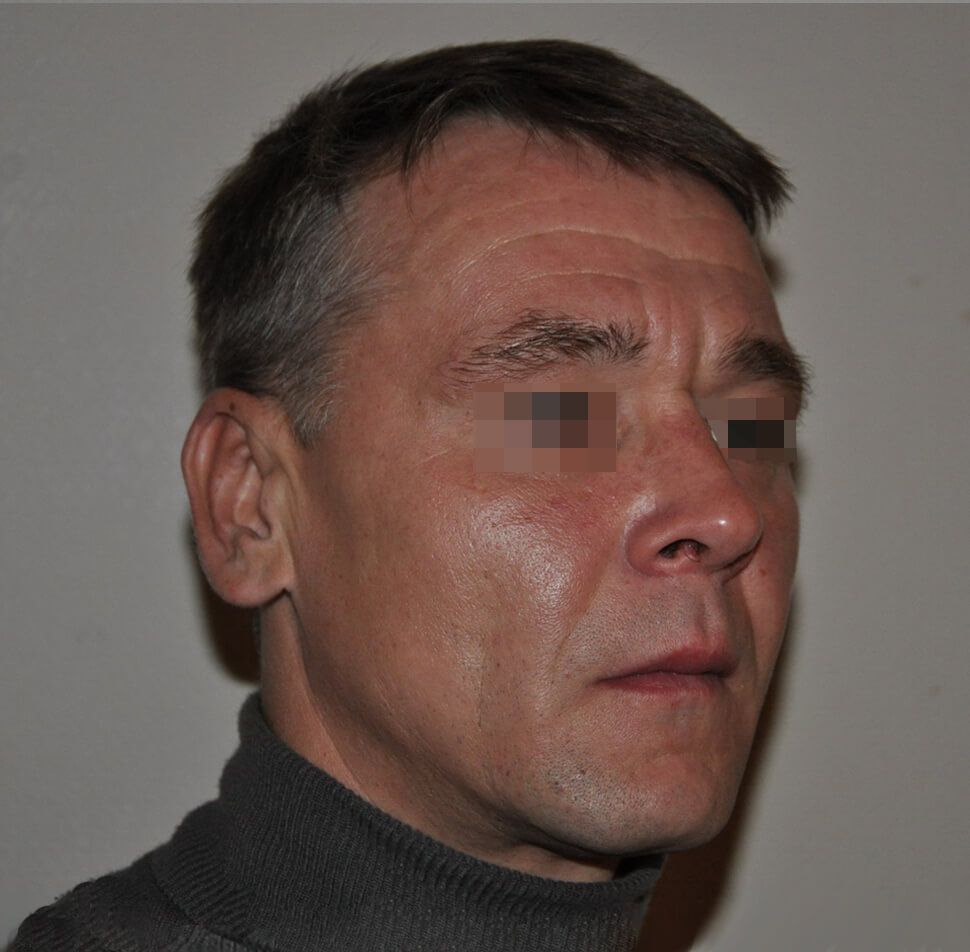 После операции После операции