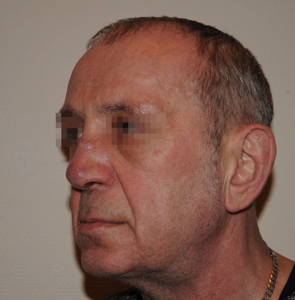 После операции После операции