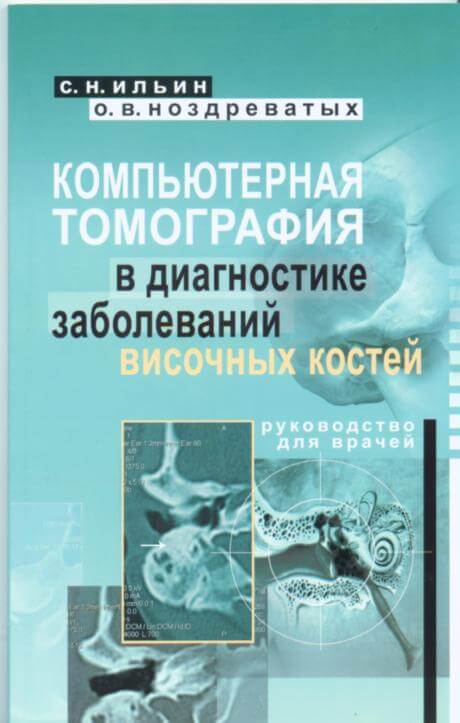 Компьютерная томография в диагностике заболеваний височных костей Компьютерная томография в диагностике заболеваний височных костей