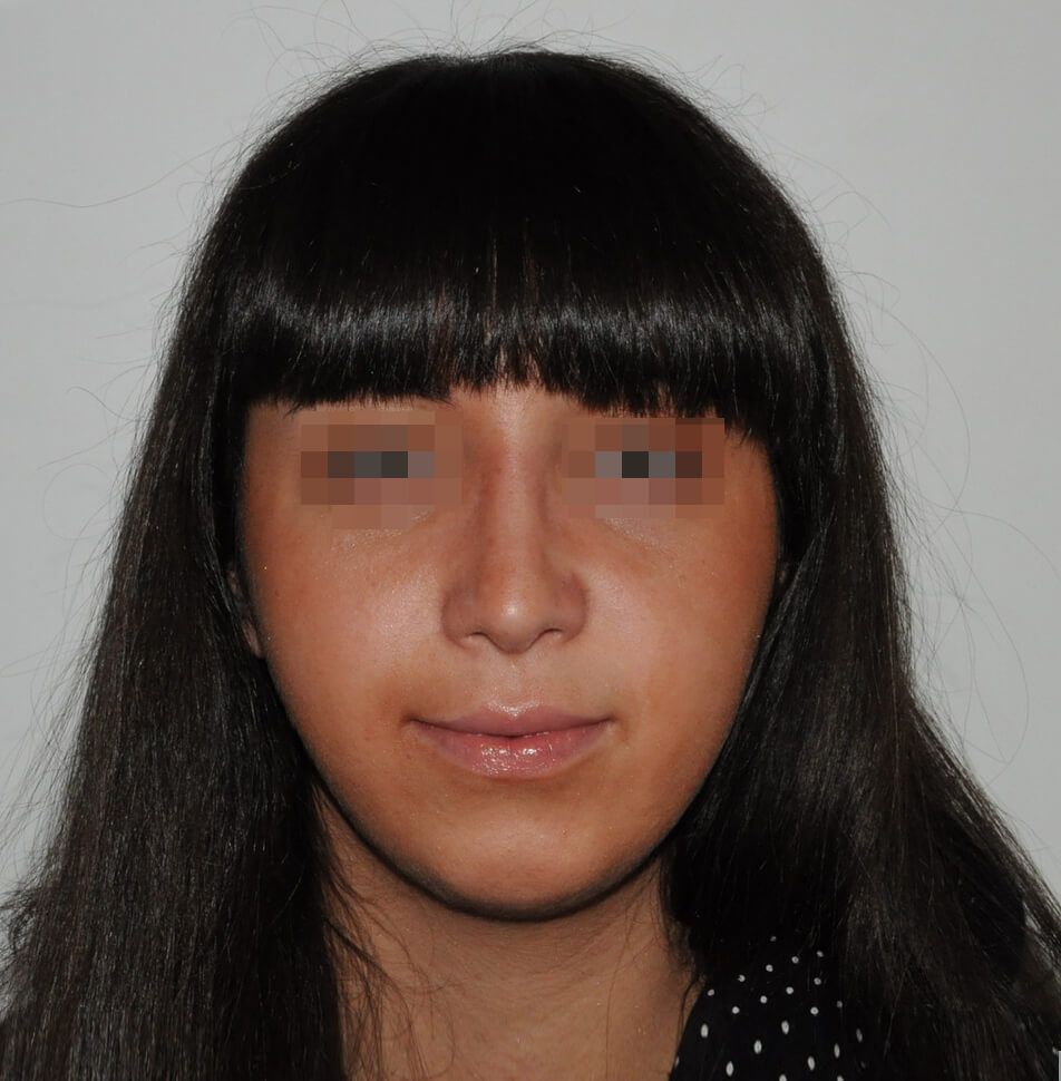 После операции После операции