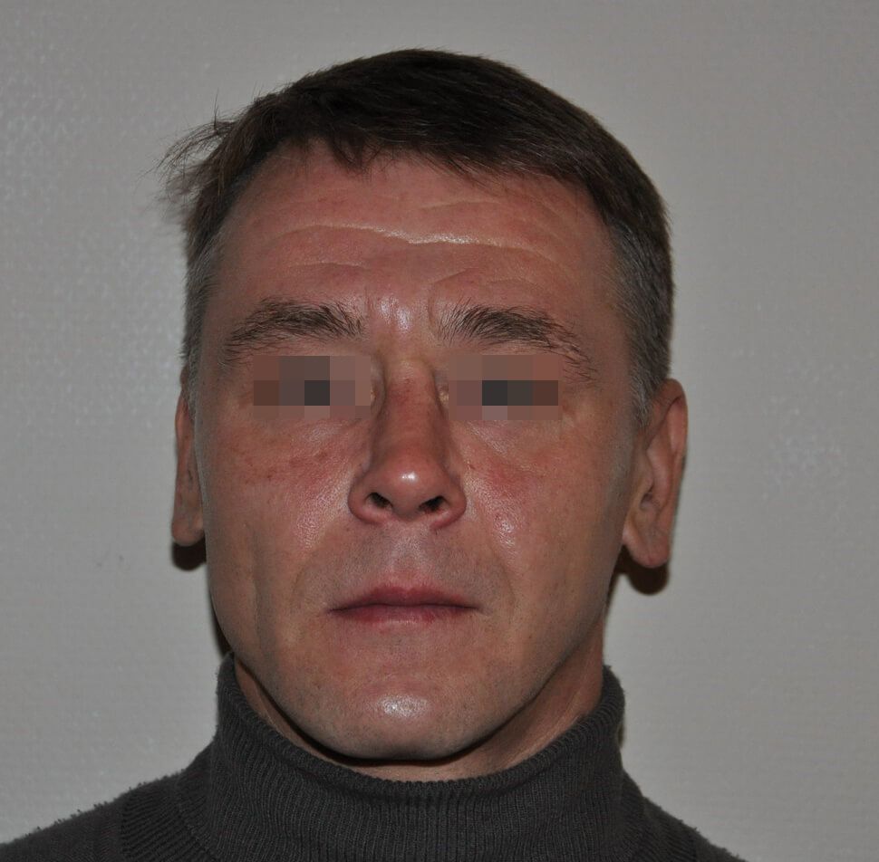 После операции После операции