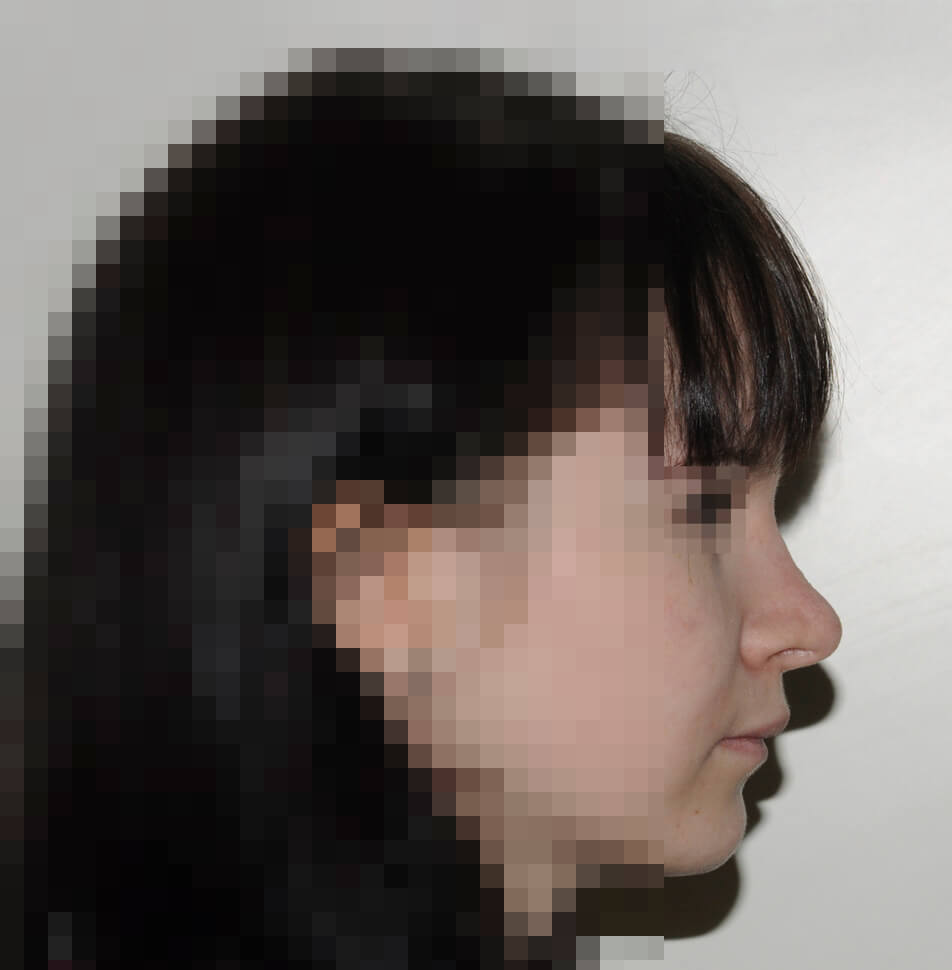 После операции После операции