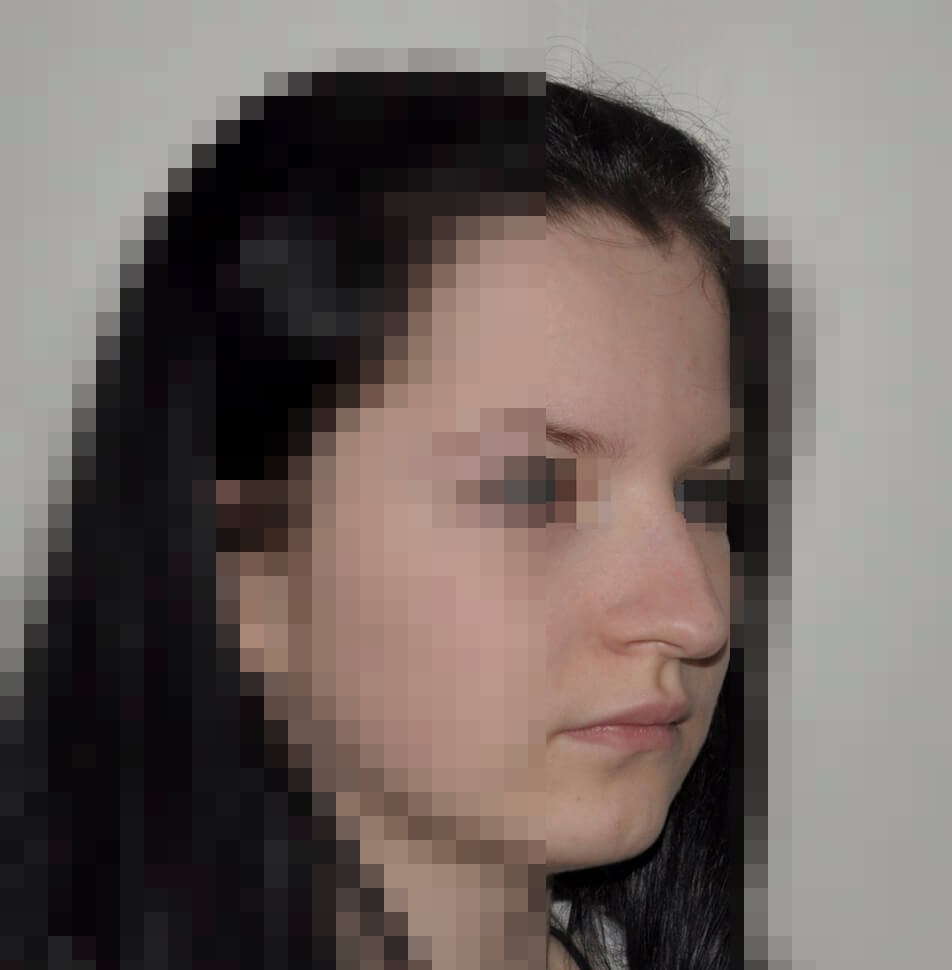 До операции До операции