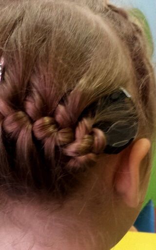 Рисунок 3. Моноблочная модель кохлеарного импланта Рисунок 3. Моноблочная модель кохлеарного импланта