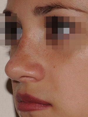 После операции После операции