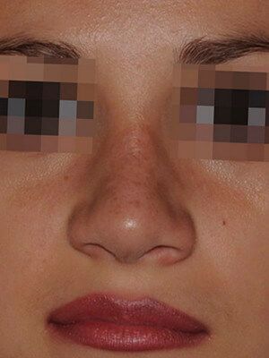 После операции После операции