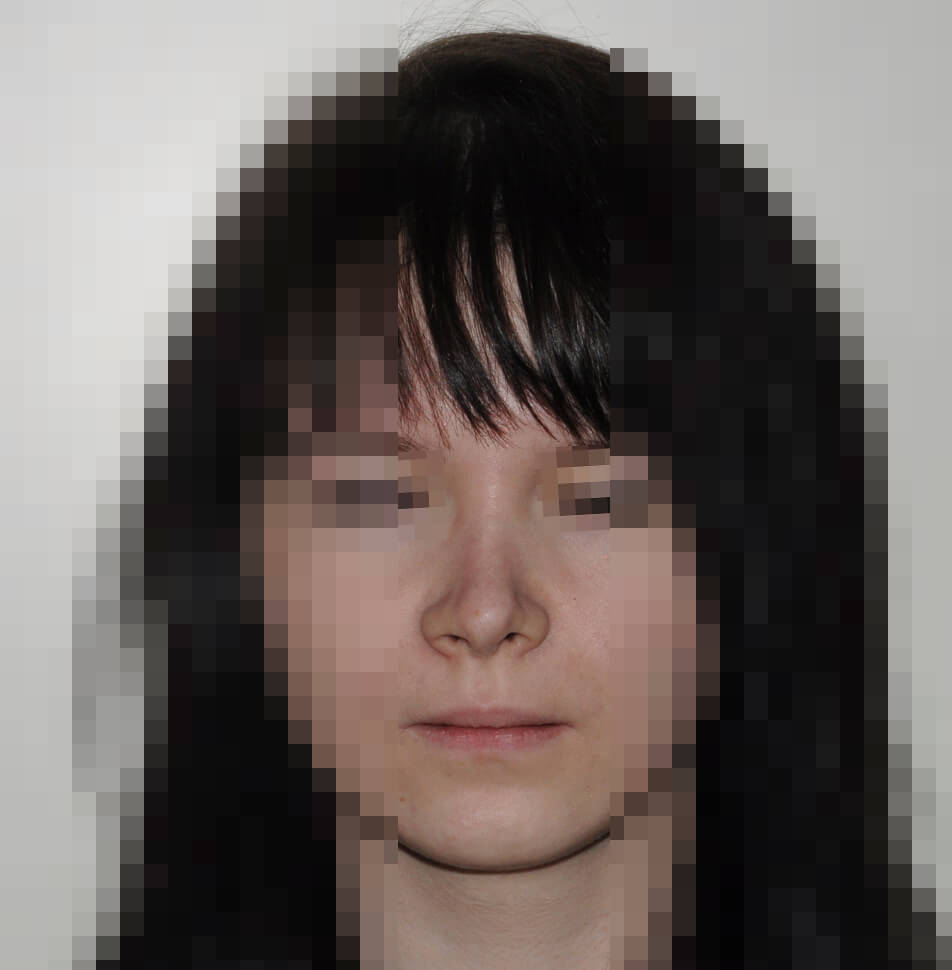 После операции После операции