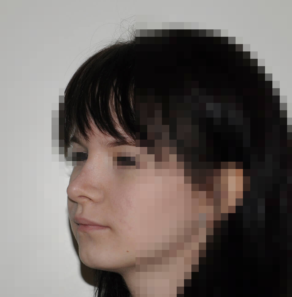 После операции После операции