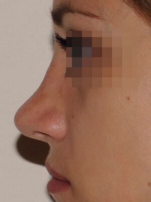 После операции После операции