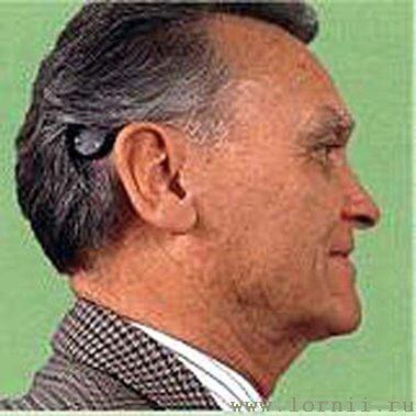 Рис.5. Место крепления аудиопроцессора Рис.5. Место крепления аудиопроцессора