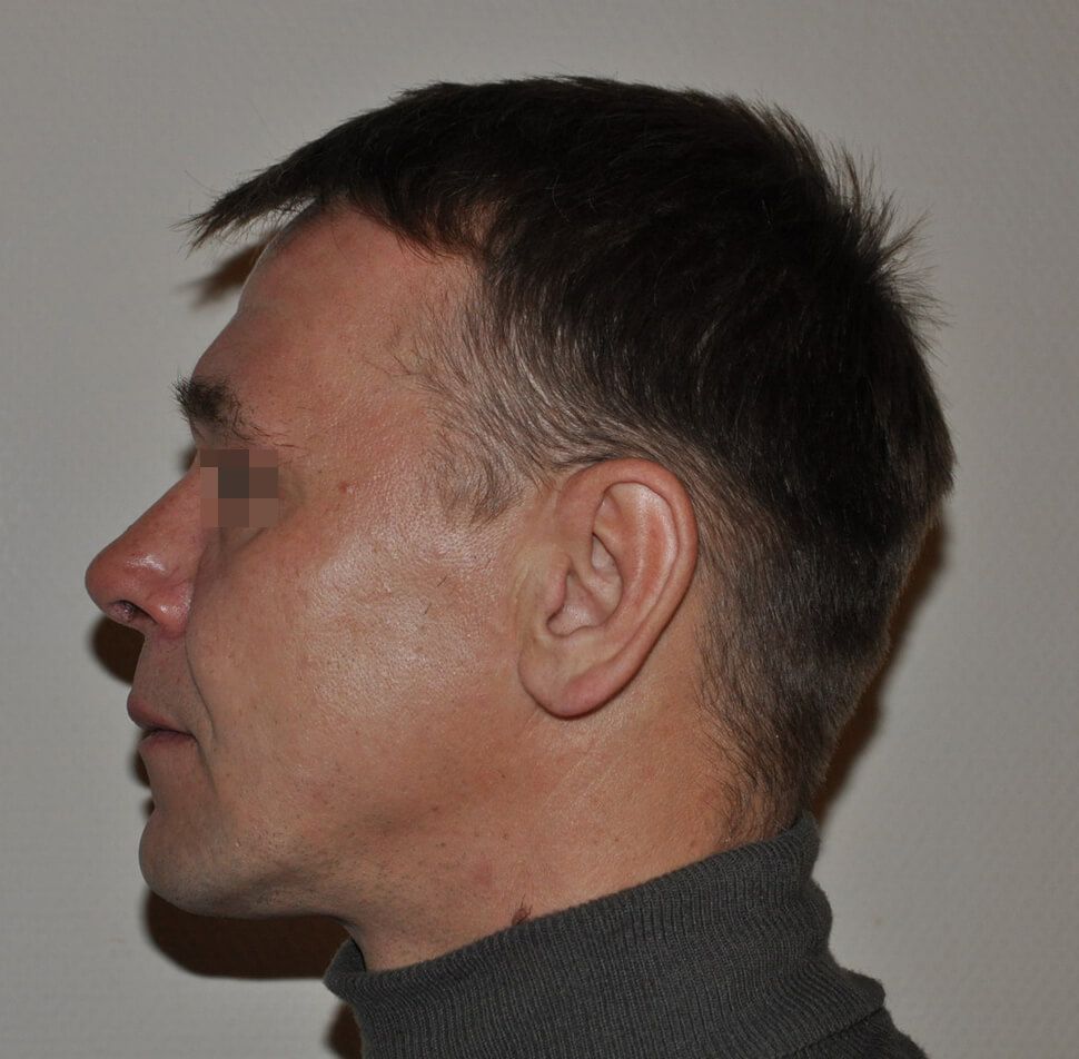 После операции После операции