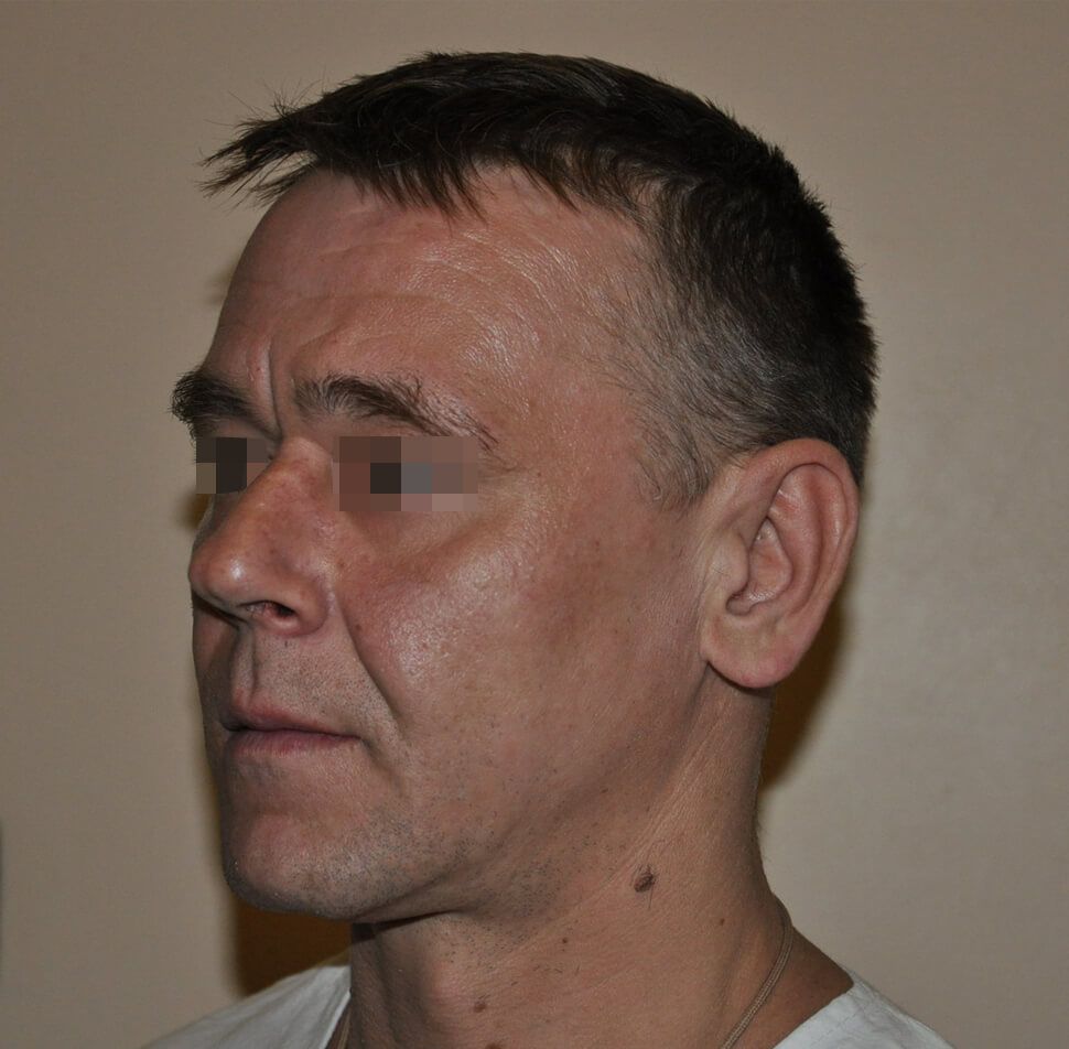 Пациент 3 Пациент 3