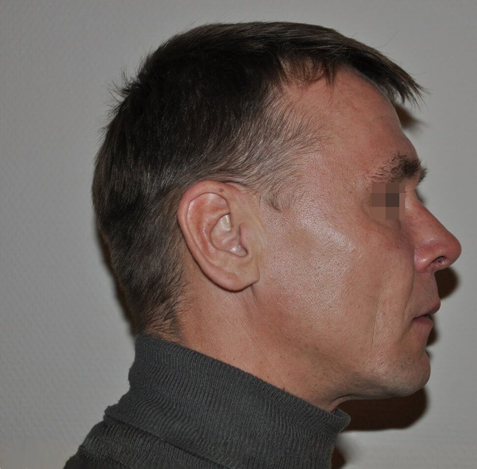 После операции После операции