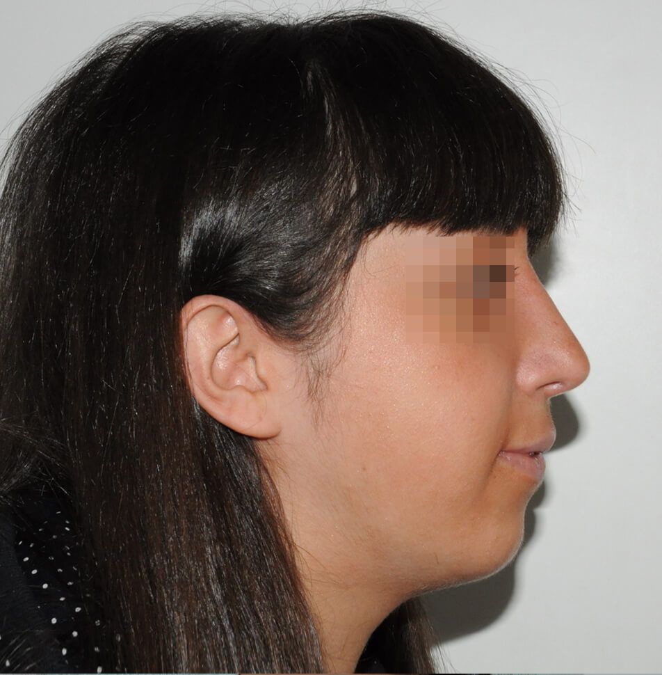 После операции После операции