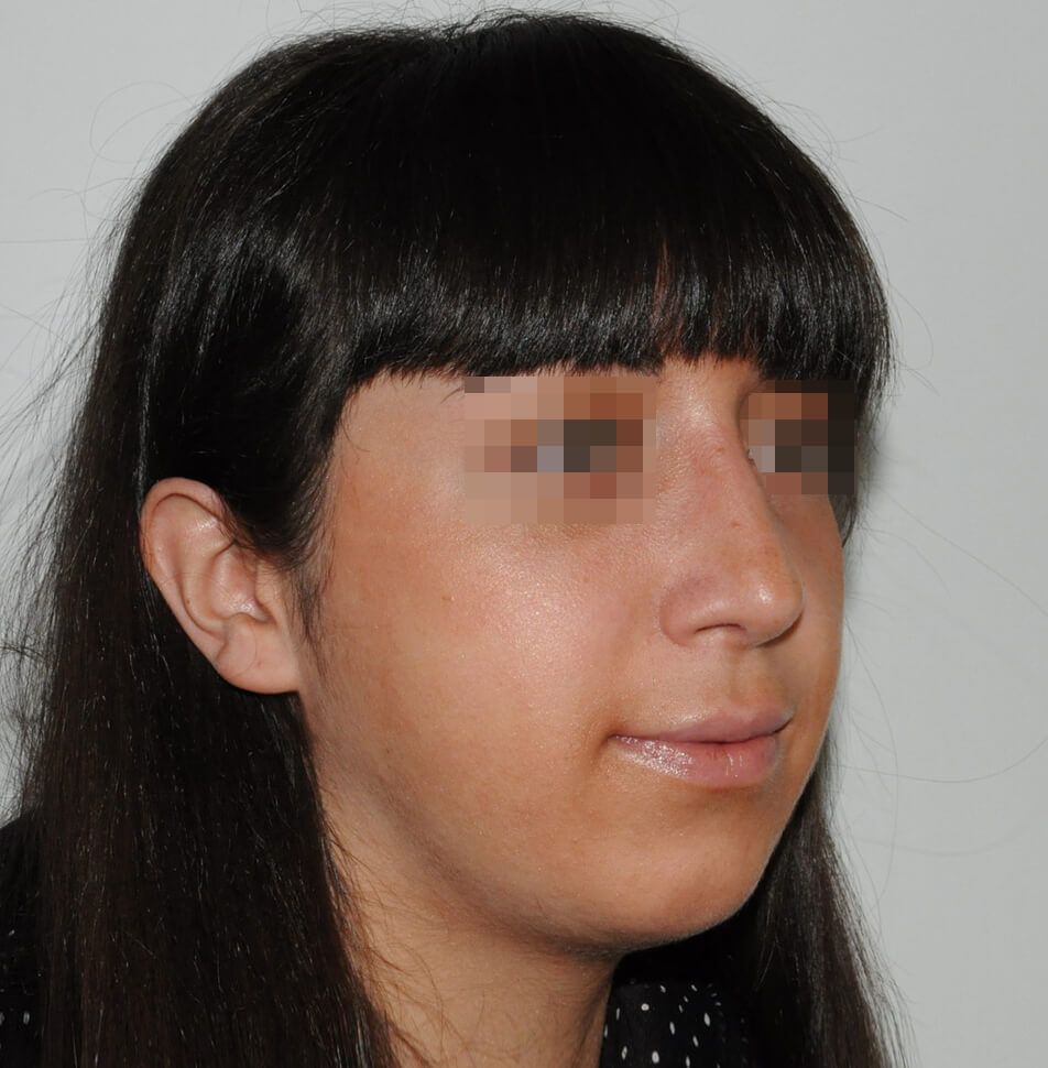 После операции После операции