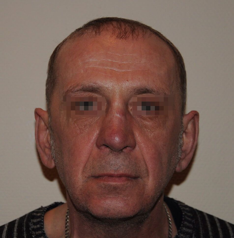 После операции После операции