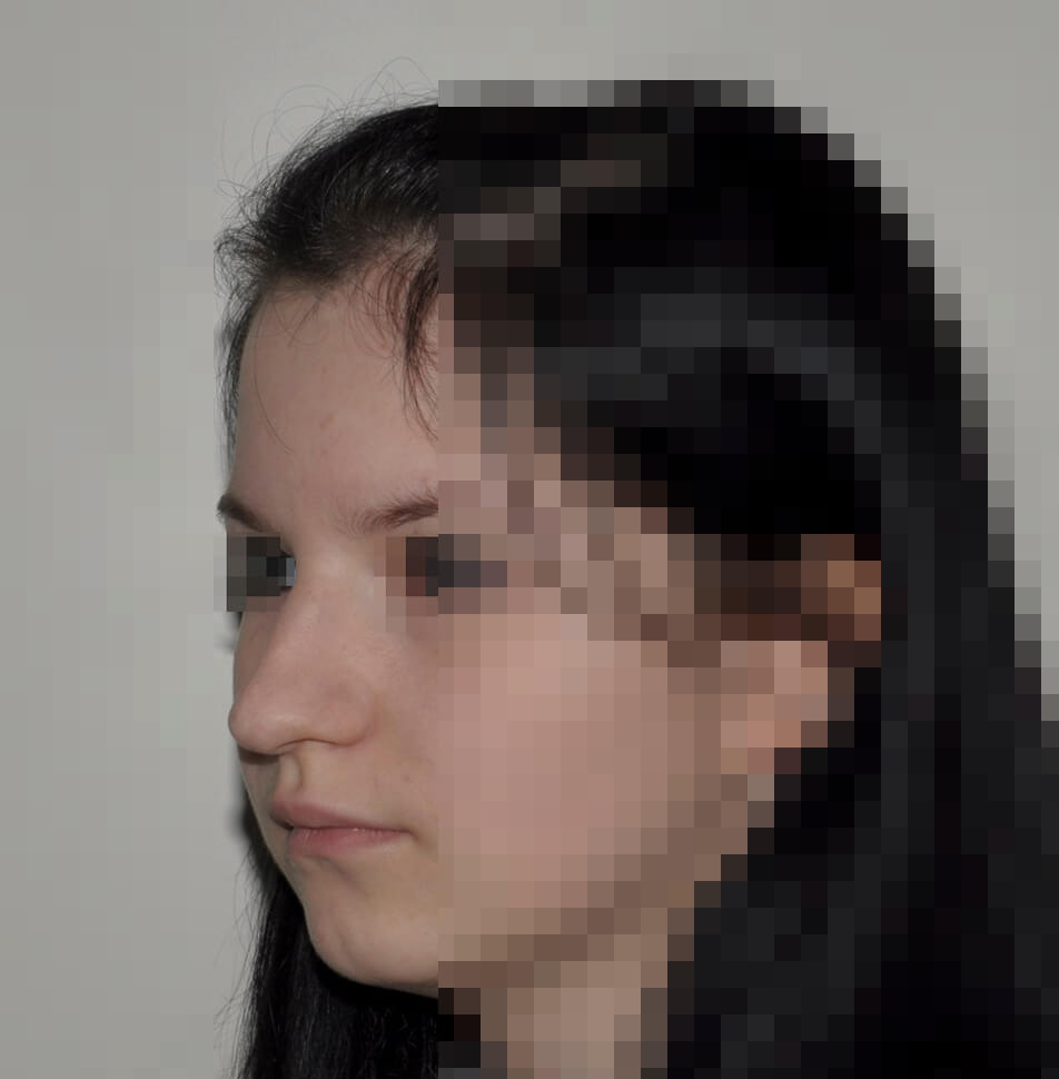 Пациент 2 Пациент 2