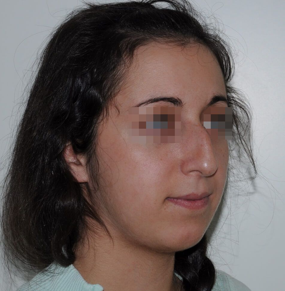 До операции До операции