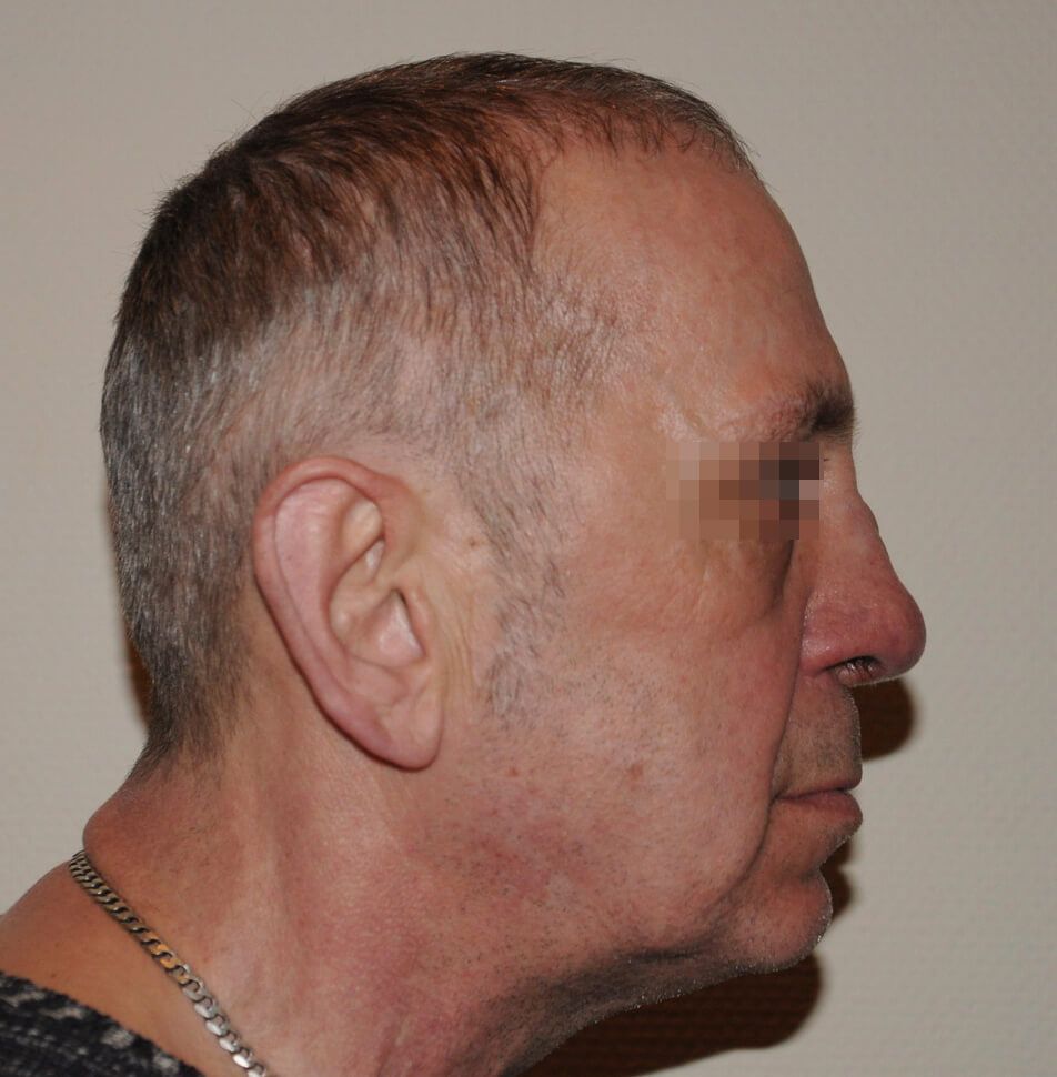 После операции После операции