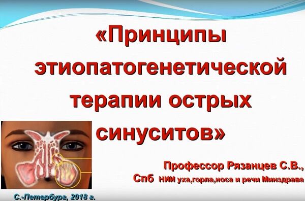 Принципы этиопатогенетической терапии острых синуситов Принципы этиопатогенетической терапии острых синуситов