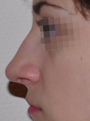 До операции До операции