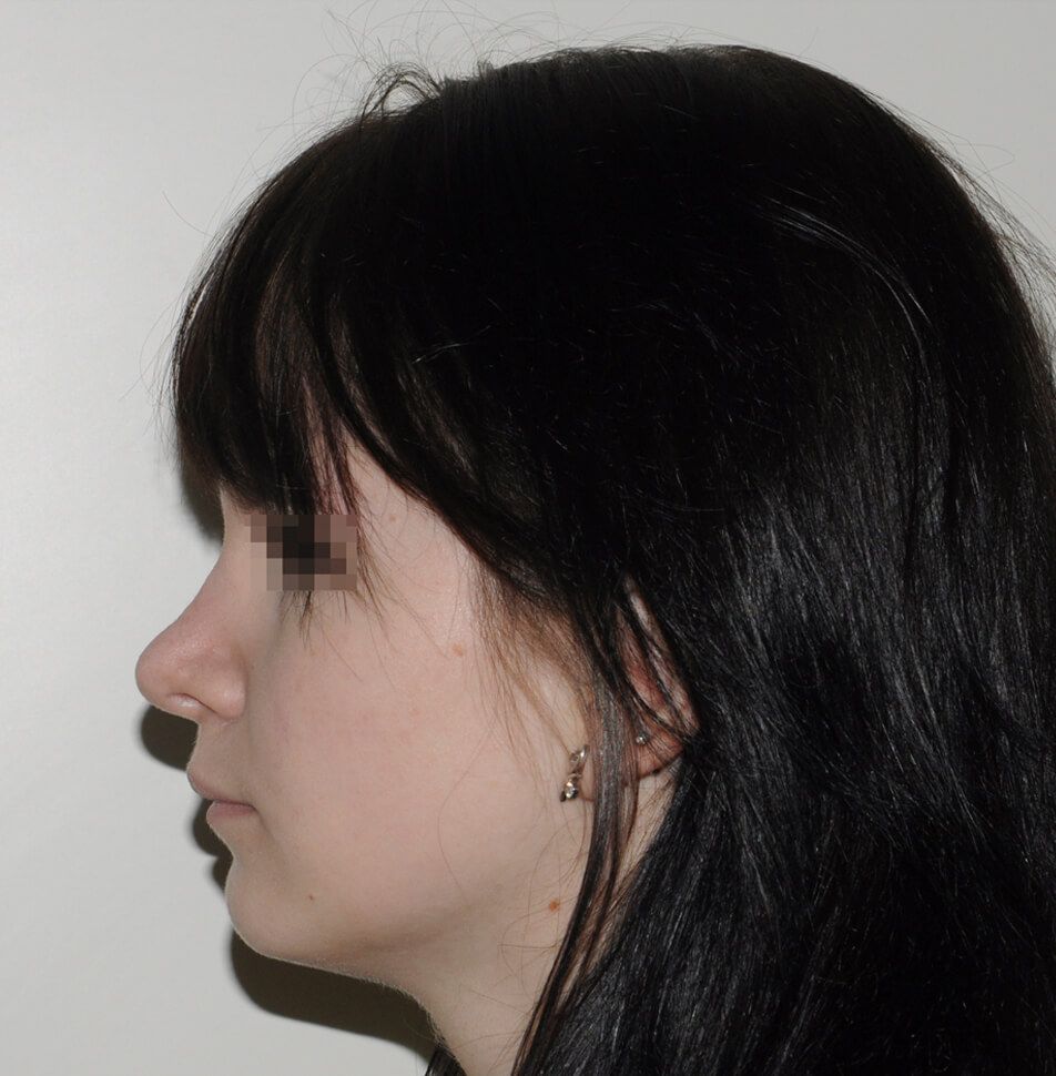 После операции После операции