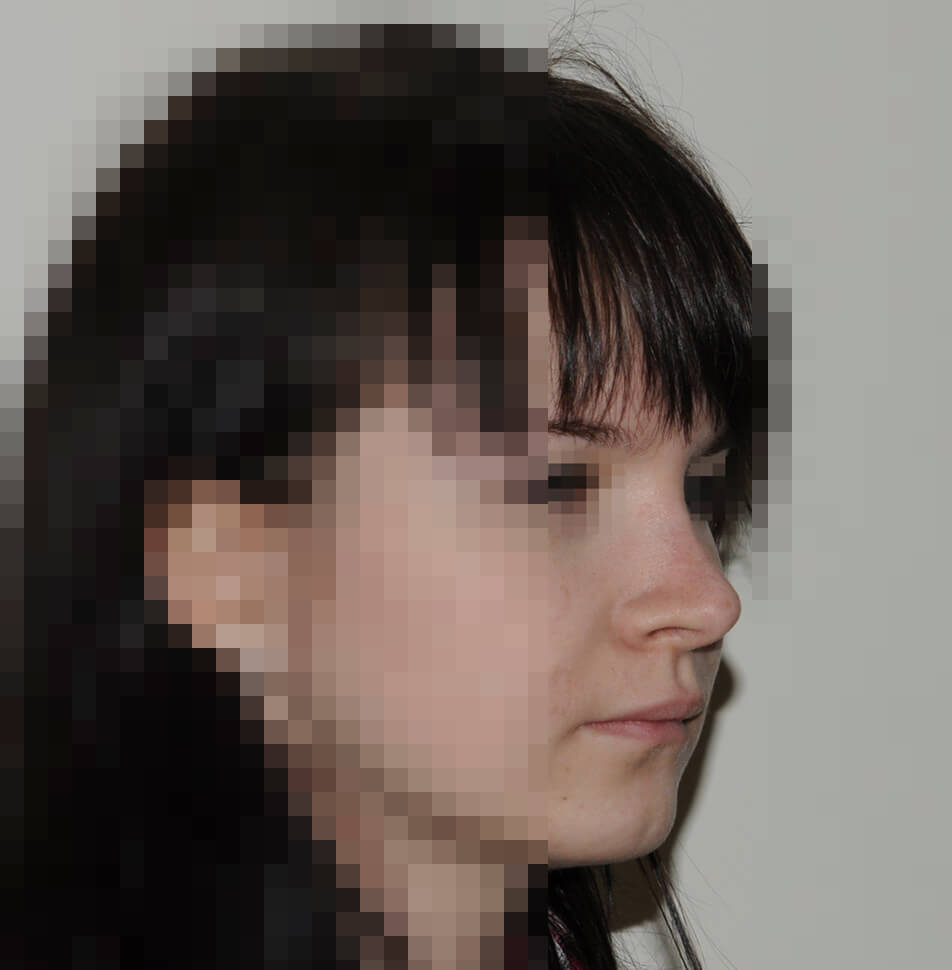 После операции После операции