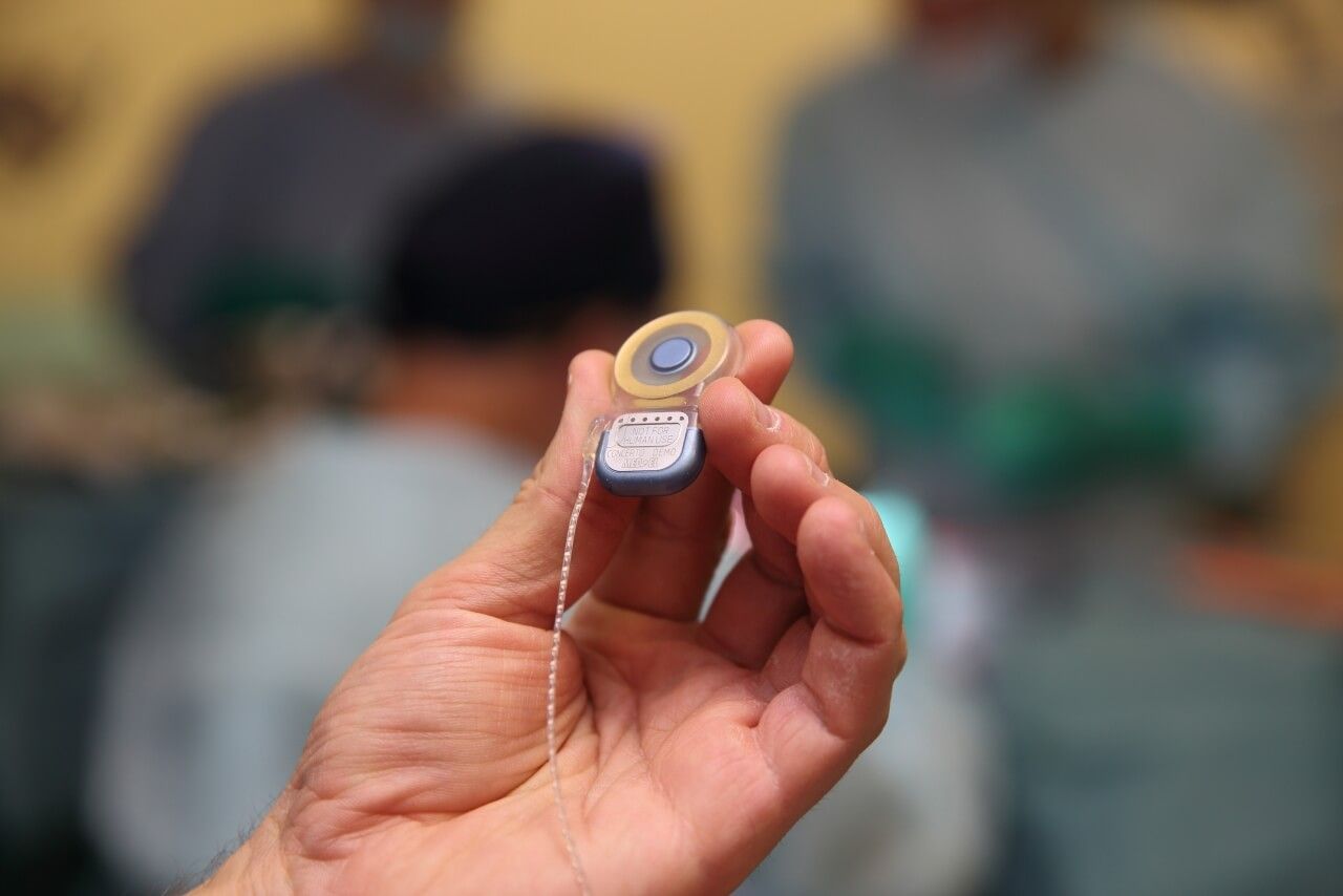 Стволомозговая слуховая имплантация Стволомозговая слуховая имплантация