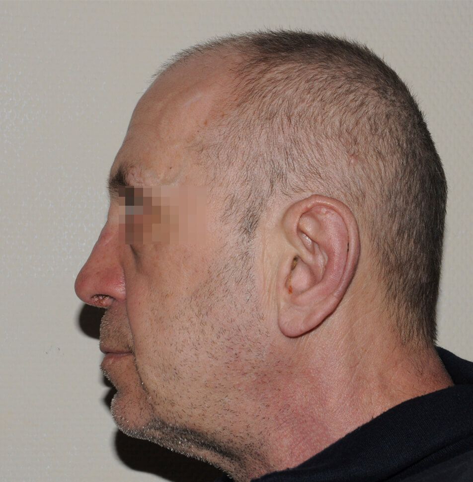 После операции После операции