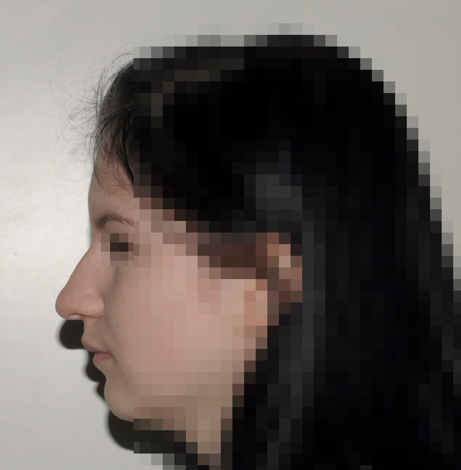 До операции До операции