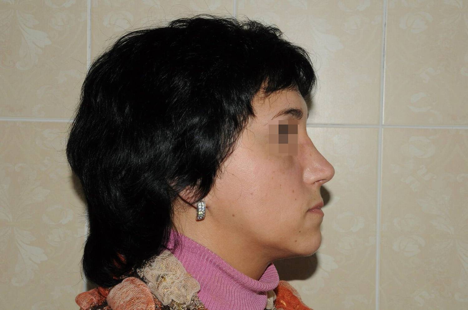 После операции После операции