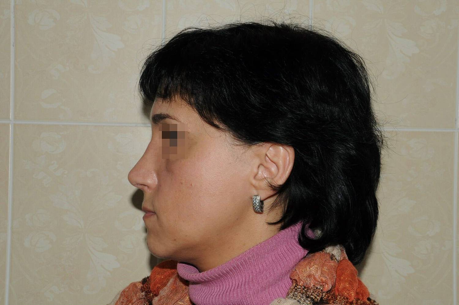 После операции После операции