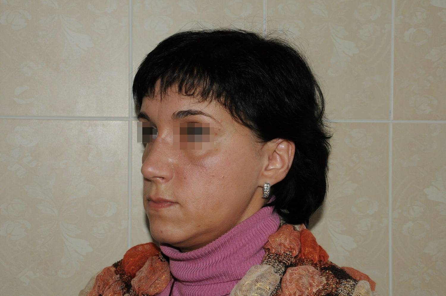 После операции После операции