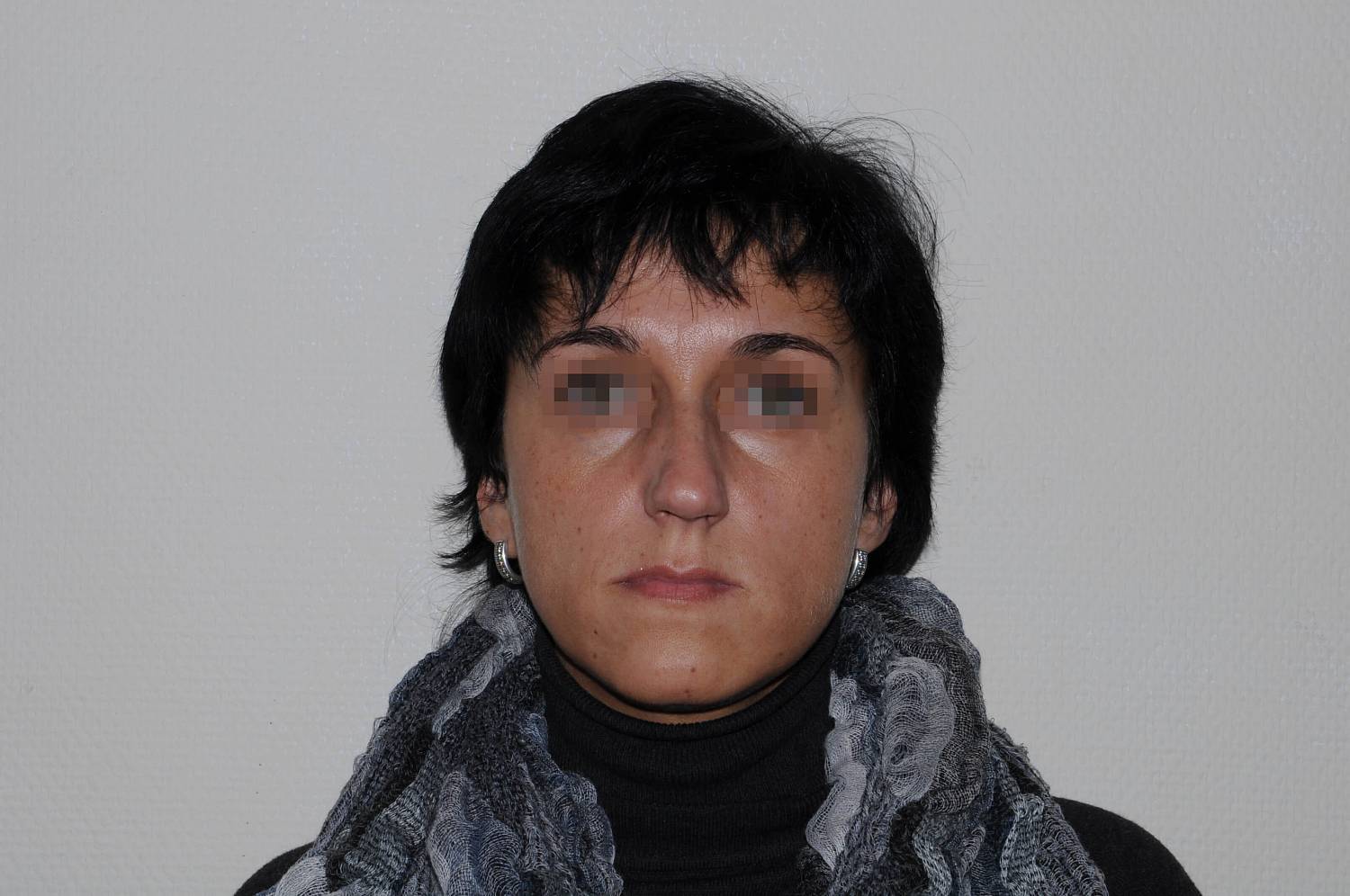 До операции До операции