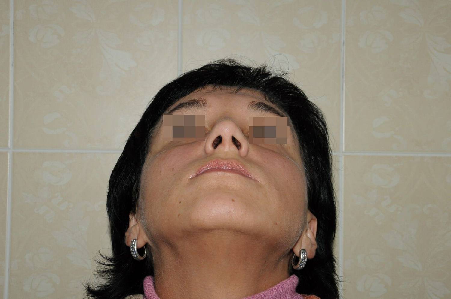 После операции После операции